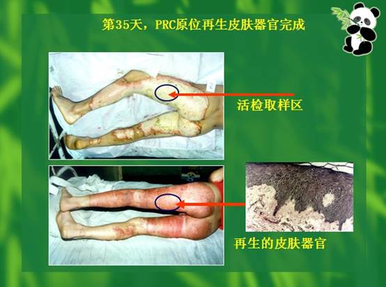 k8凯发官网(中国)天生赢家·一触即发