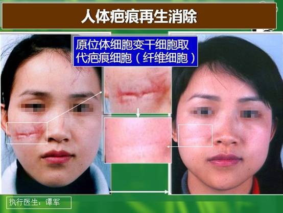 k8凯发官网(中国)天生赢家·一触即发