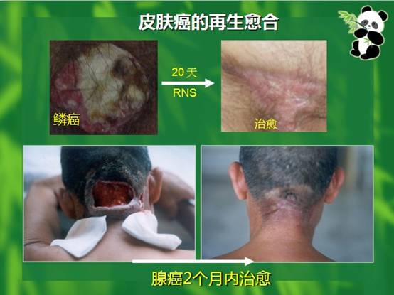 k8凯发官网(中国)天生赢家·一触即发