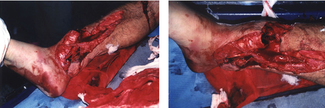 k8凯发官网(中国)天生赢家·一触即发