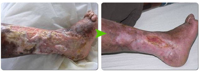 k8凯发官网(中国)天生赢家·一触即发