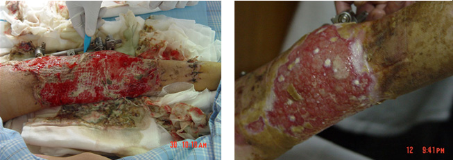 k8凯发官网(中国)天生赢家·一触即发