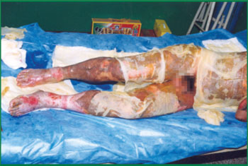 k8凯发官网(中国)天生赢家·一触即发