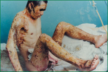 k8凯发官网(中国)天生赢家·一触即发