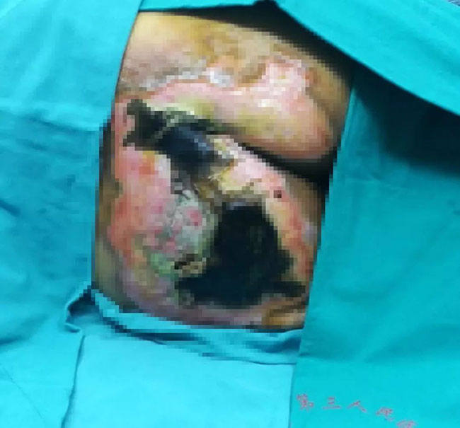 k8凯发官网(中国)天生赢家·一触即发