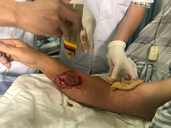 k8凯发官网(中国)天生赢家·一触即发