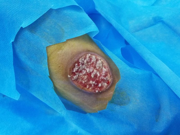 k8凯发官网(中国)天生赢家·一触即发