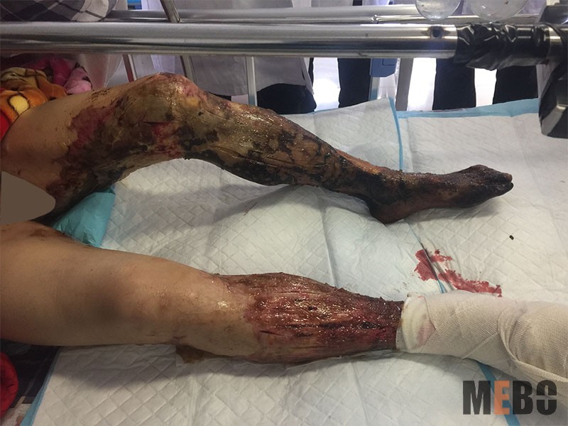 k8凯发官网(中国)天生赢家·一触即发