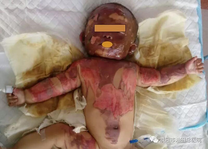 k8凯发官网(中国)天生赢家·一触即发