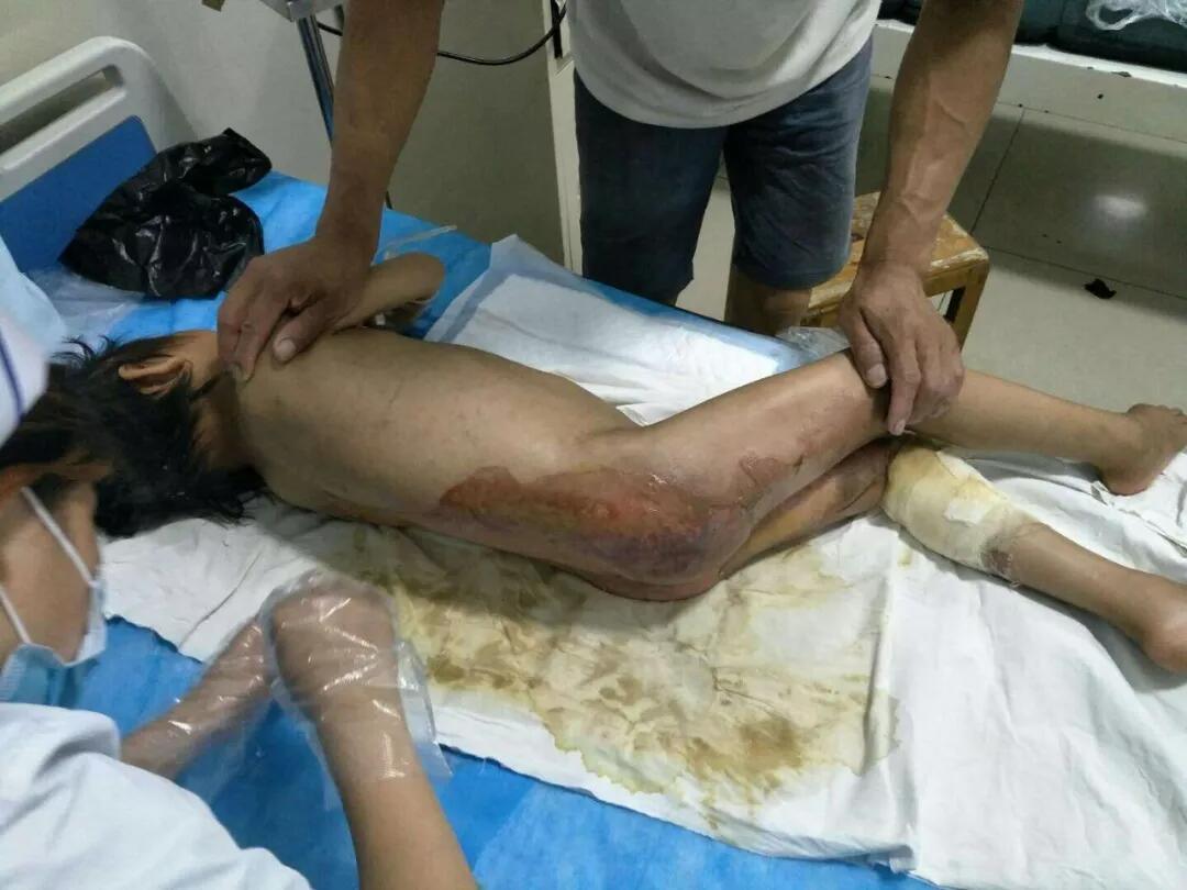 k8凯发官网(中国)天生赢家·一触即发