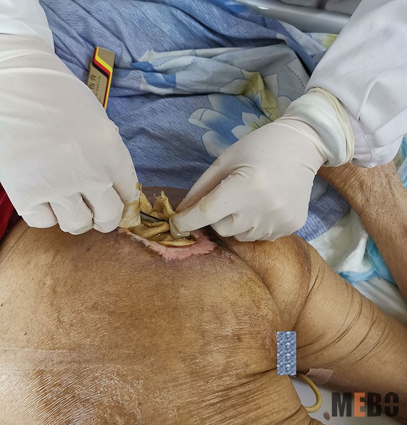 k8凯发官网(中国)天生赢家·一触即发