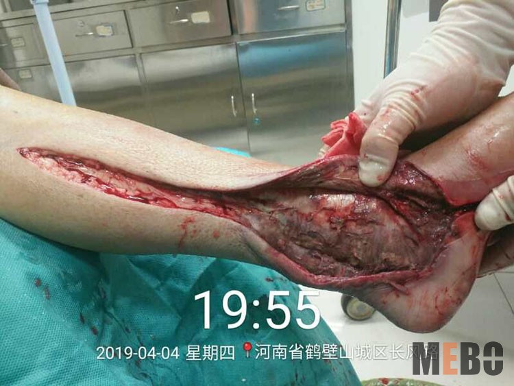 k8凯发官网(中国)天生赢家·一触即发