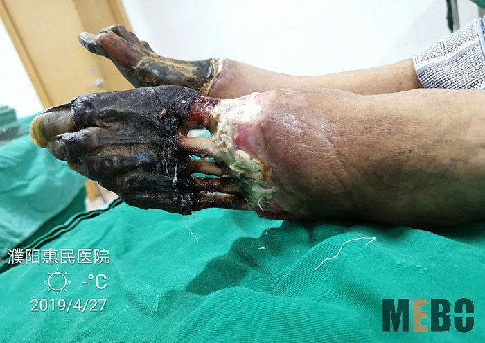 k8凯发官网(中国)天生赢家·一触即发