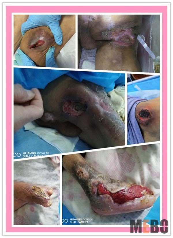 k8凯发官网(中国)天生赢家·一触即发