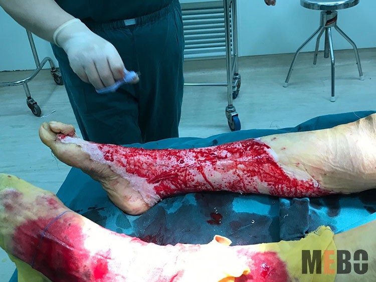 k8凯发官网(中国)天生赢家·一触即发