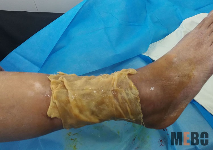 k8凯发官网(中国)天生赢家·一触即发