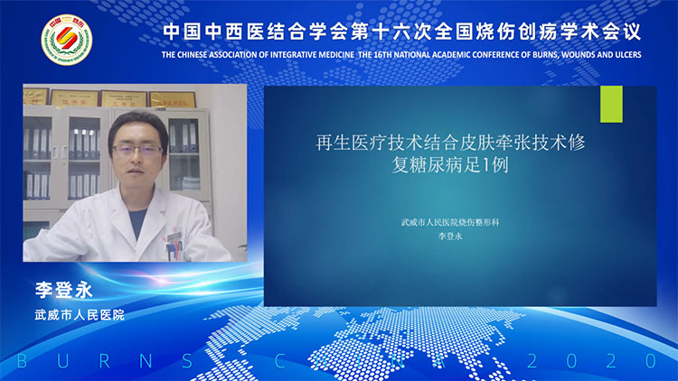 k8凯发官网(中国)天生赢家·一触即发