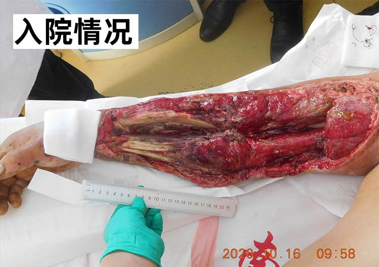 k8凯发官网(中国)天生赢家·一触即发