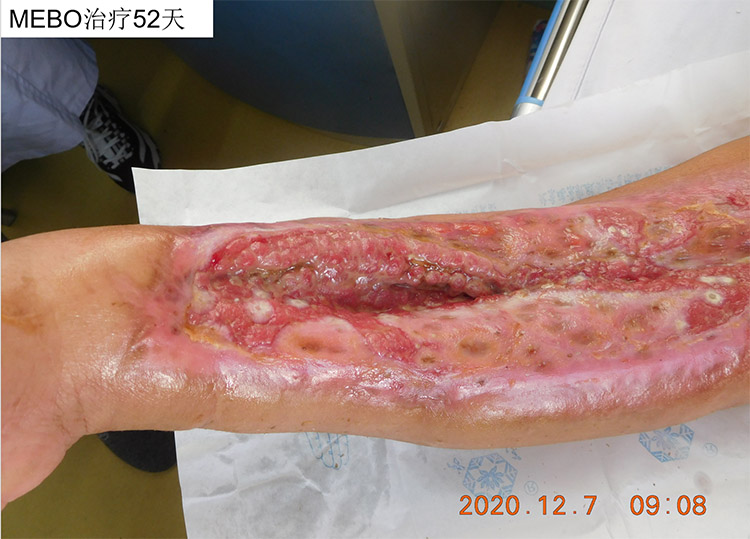 k8凯发官网(中国)天生赢家·一触即发