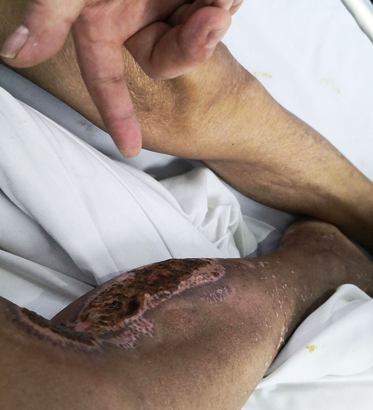 k8凯发官网(中国)天生赢家·一触即发