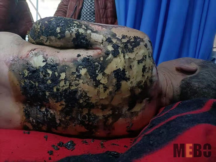 k8凯发官网(中国)天生赢家·一触即发