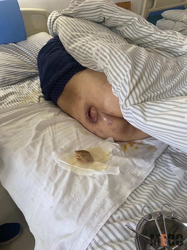 k8凯发官网(中国)天生赢家·一触即发