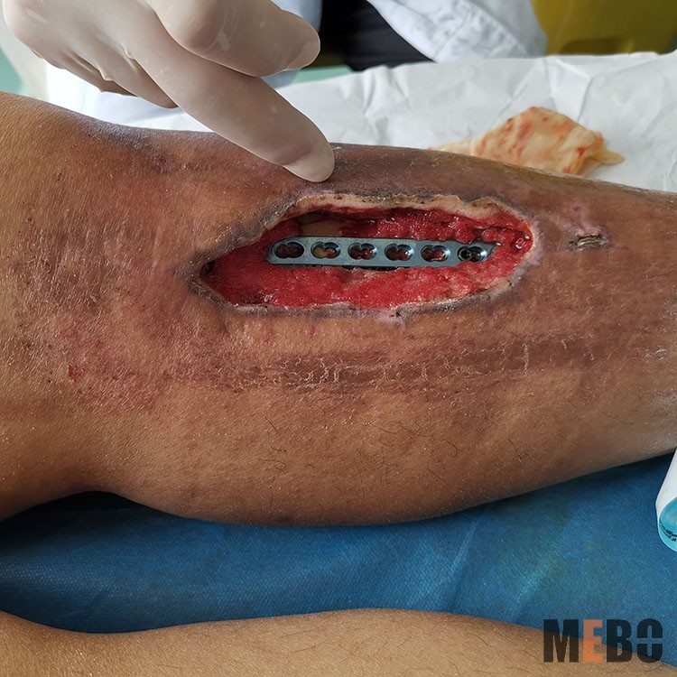 k8凯发官网(中国)天生赢家·一触即发