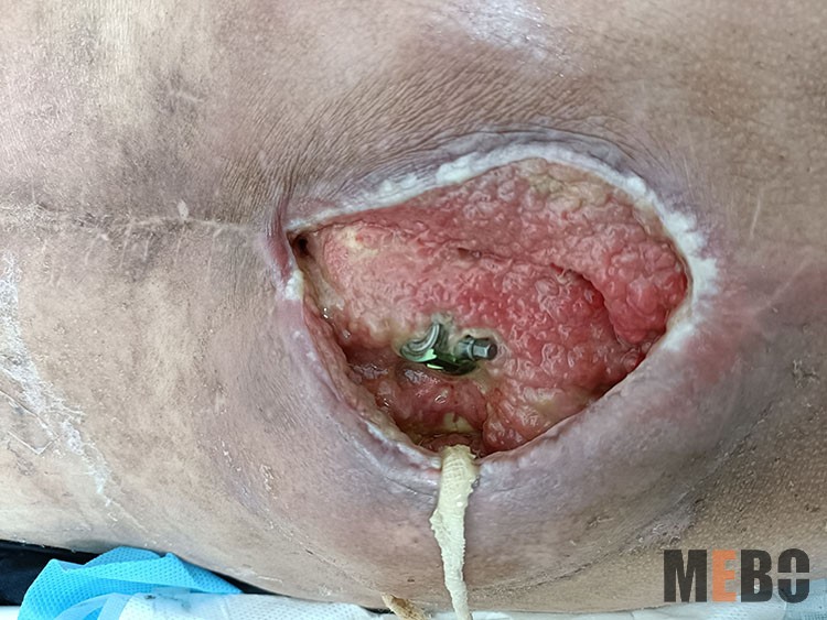 k8凯发官网(中国)天生赢家·一触即发