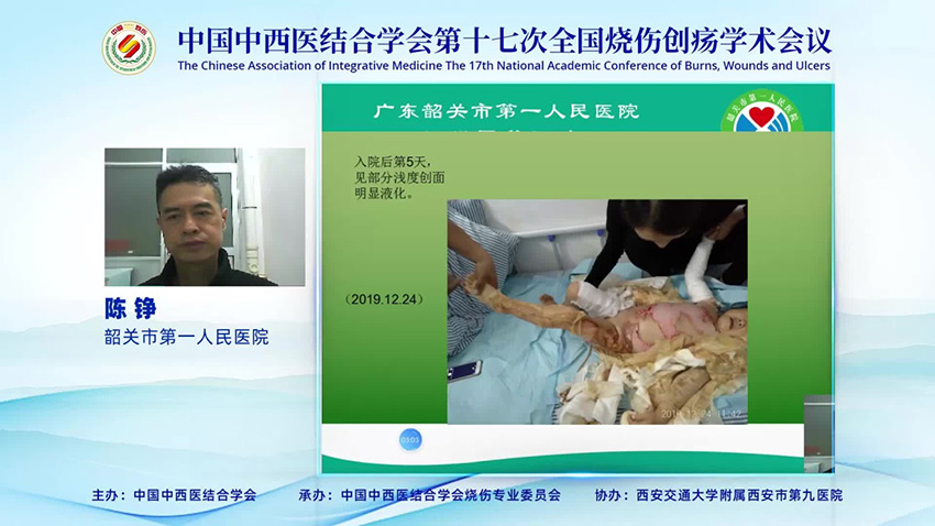 k8凯发官网(中国)天生赢家·一触即发