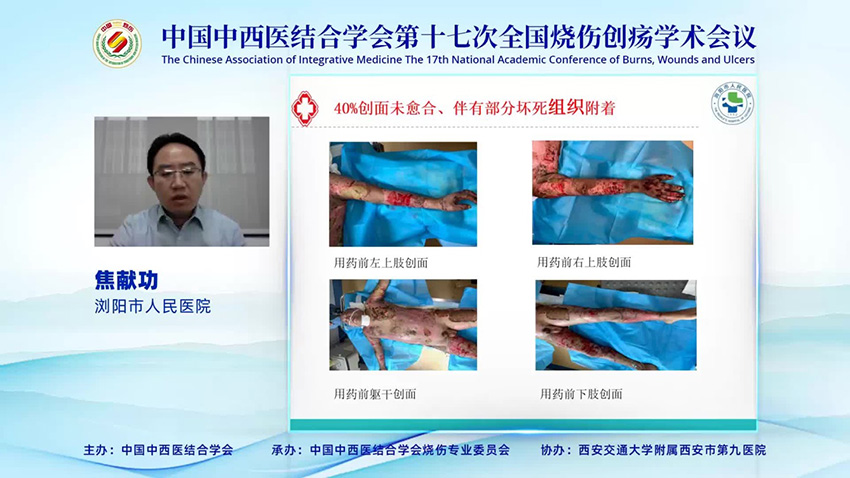 k8凯发官网(中国)天生赢家·一触即发