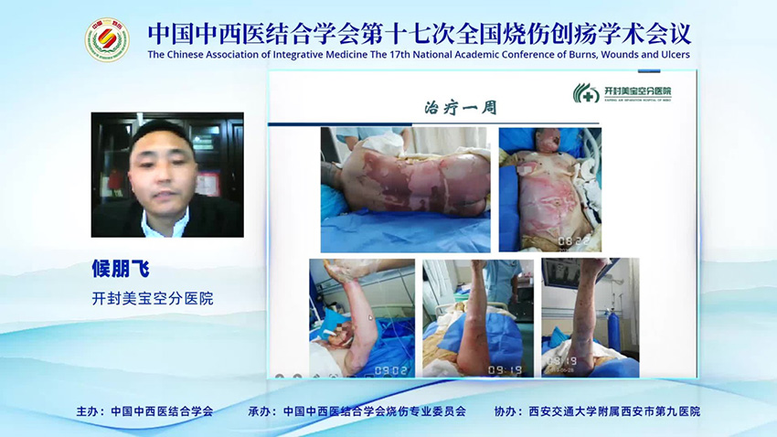 k8凯发官网(中国)天生赢家·一触即发