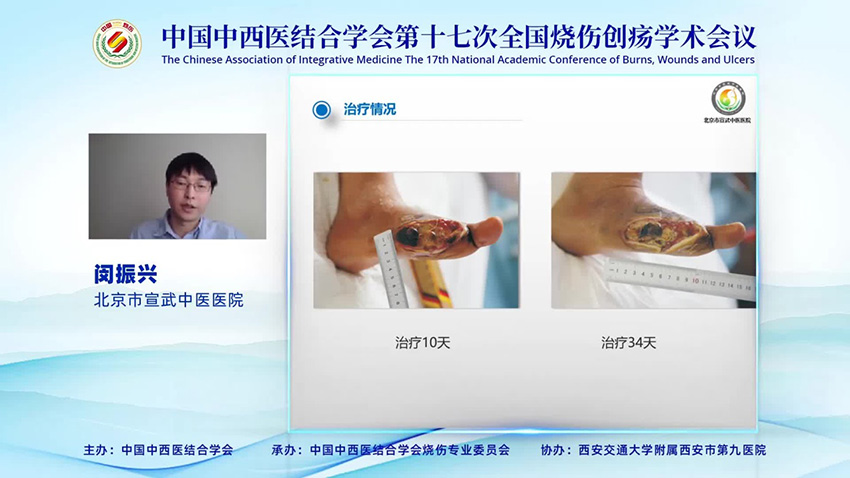 k8凯发官网(中国)天生赢家·一触即发