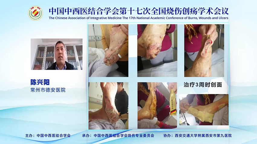 k8凯发官网(中国)天生赢家·一触即发