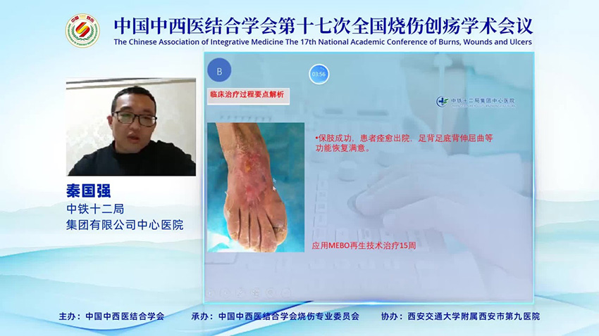 k8凯发官网(中国)天生赢家·一触即发