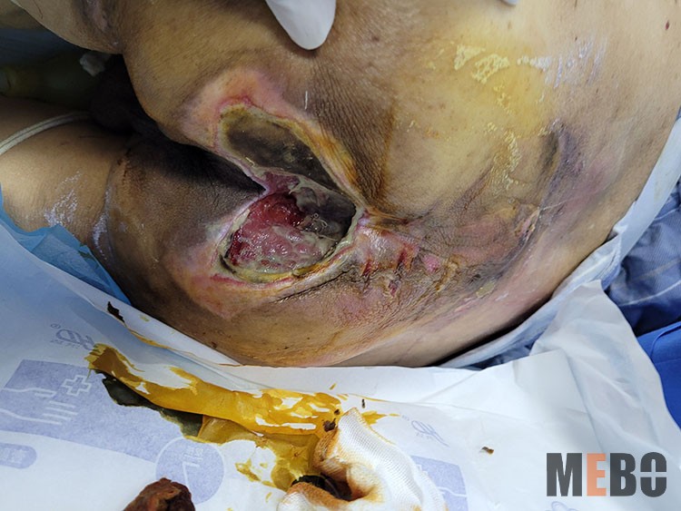 k8凯发官网(中国)天生赢家·一触即发