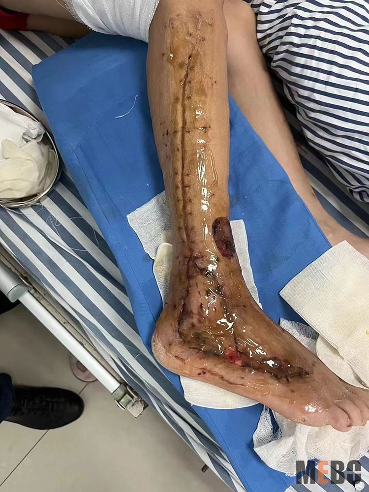 k8凯发官网(中国)天生赢家·一触即发