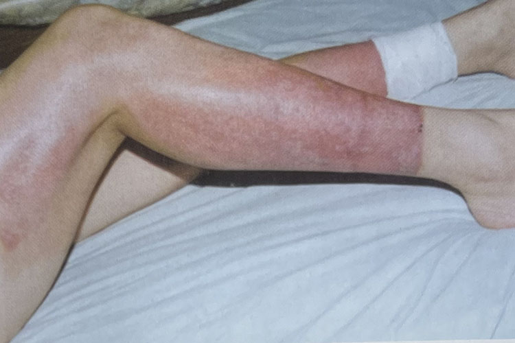 k8凯发官网(中国)天生赢家·一触即发