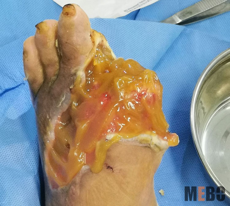 k8凯发官网(中国)天生赢家·一触即发