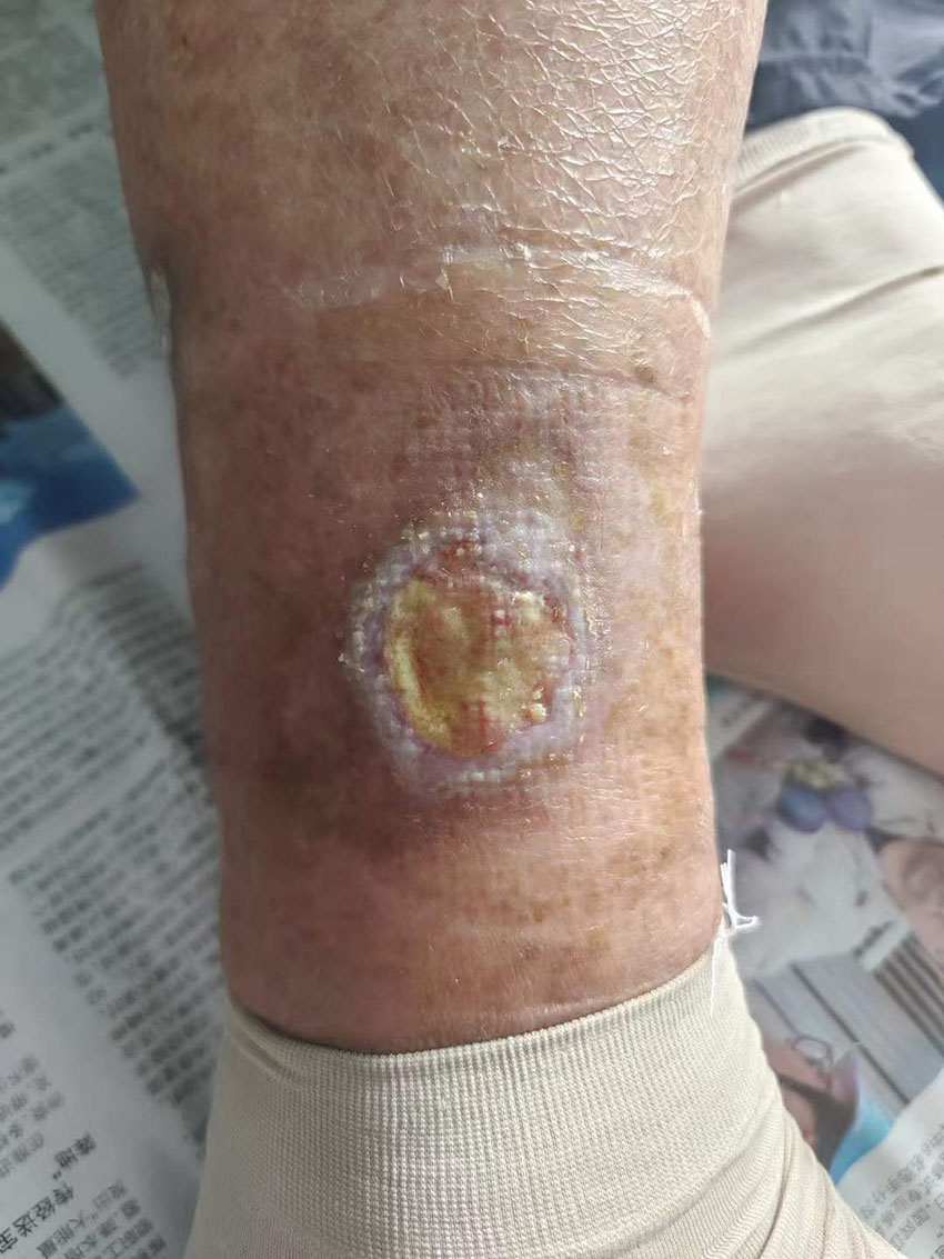 k8凯发官网(中国)天生赢家·一触即发