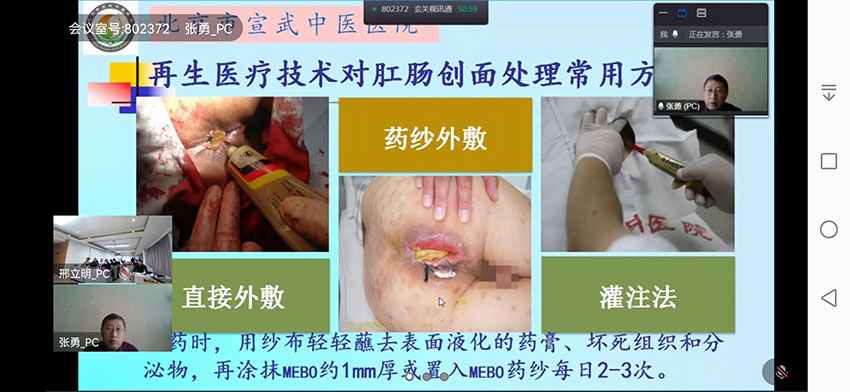 k8凯发官网(中国)天生赢家·一触即发