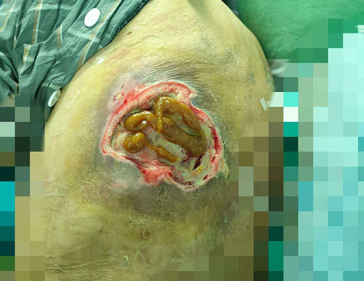 k8凯发官网(中国)天生赢家·一触即发