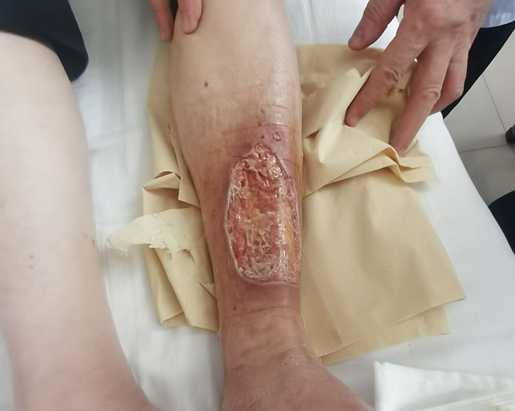 k8凯发官网(中国)天生赢家·一触即发