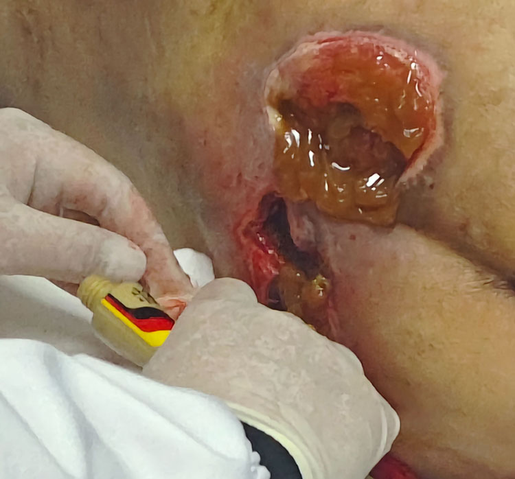 k8凯发官网(中国)天生赢家·一触即发