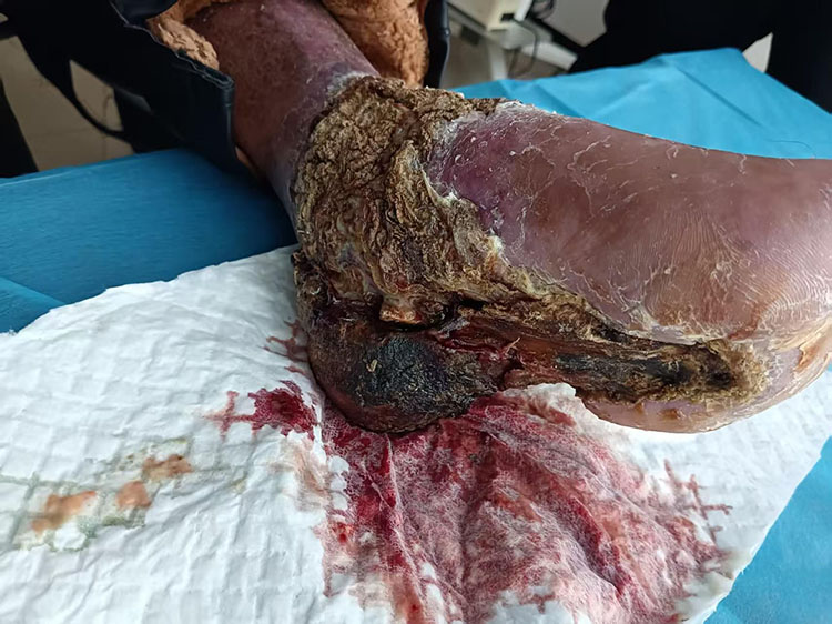 k8凯发官网(中国)天生赢家·一触即发