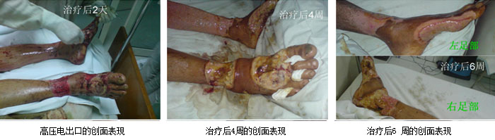 k8凯发官网(中国)天生赢家·一触即发