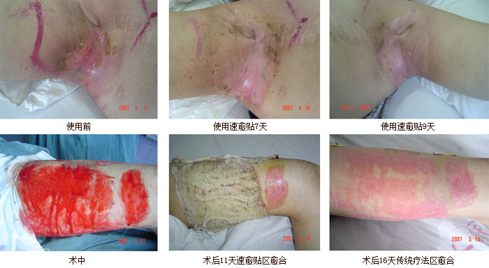 k8凯发官网(中国)天生赢家·一触即发