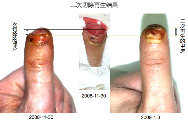 k8凯发官网(中国)天生赢家·一触即发