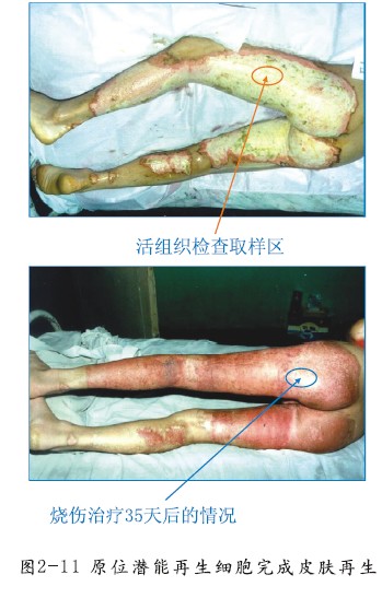 k8凯发官网(中国)天生赢家·一触即发