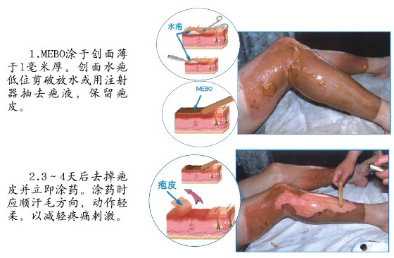 k8凯发官网(中国)天生赢家·一触即发
