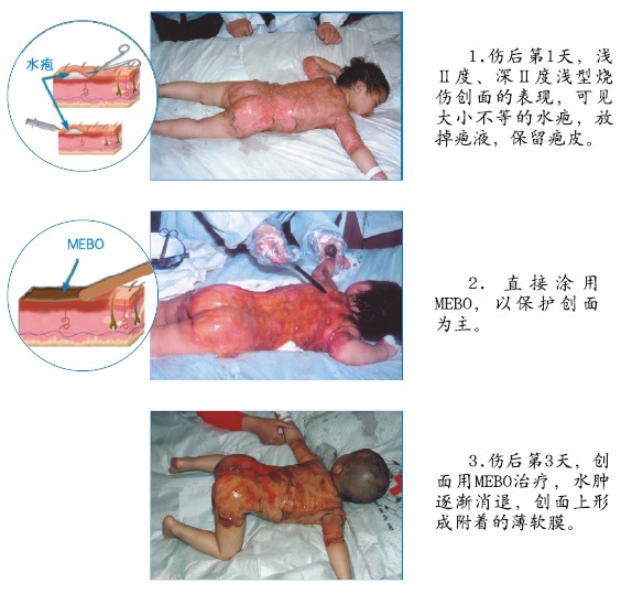 k8凯发官网(中国)天生赢家·一触即发